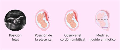 Imagen de ecografía fetal en tercer trimestre mostrando el perfil completo del bebé