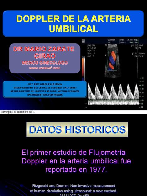 Gráfico explicando las ondas de flujo Doppler en la arteria umbilical