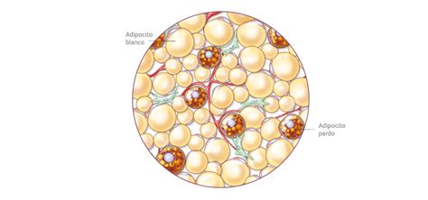 Esquema anatómico de la mama mostrando la diferencia visual entre tejido adiposo (oscuro) y tejido fibroglandular denso (blanco) en una mamografía.