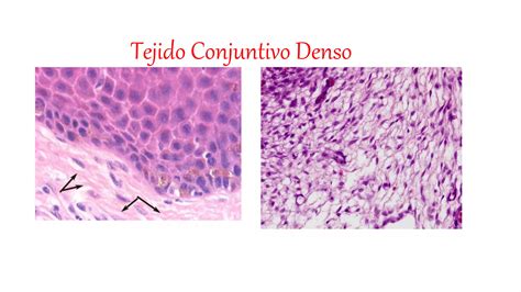 Comparativa visual: Tumor oculto en tejido denso frente a la detección mejorada mediante tecnología 3D.