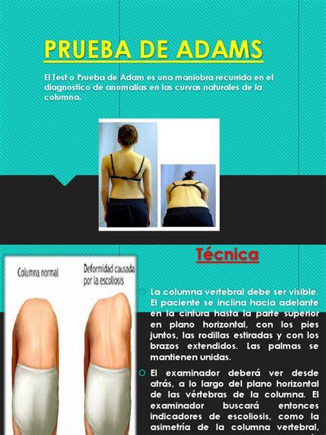 Ilustración de la prueba de Adams (inclinación hacia adelante) para detectar deformidades en la espalda.