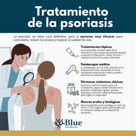 Esquema informativo sobre la seguridad de los tratamientos para la psoriasis durante la lactancia, diferenciando entre opciones tópicas, sistémicas y biológicas.