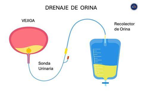Imagen de una persona utilizando una sonda para sexar una serpiente