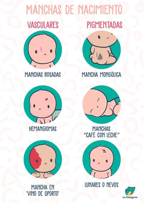 Ilustración comparativa de los diferentes tipos de manchas de nacimiento (vasculares y pigmentadas) con ejemplos visuales claros.