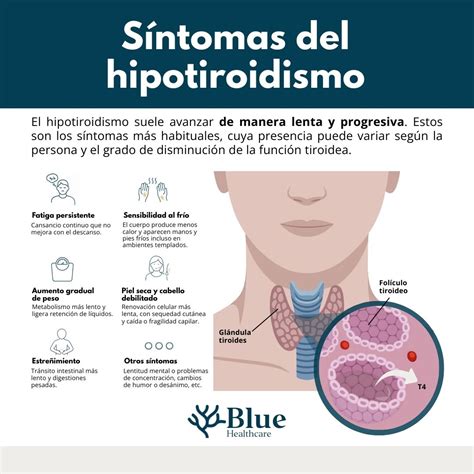 Infografía comparativa: síntomas comunes en el recién nacido con hipotiroidismo frente a un desarrollo normal.