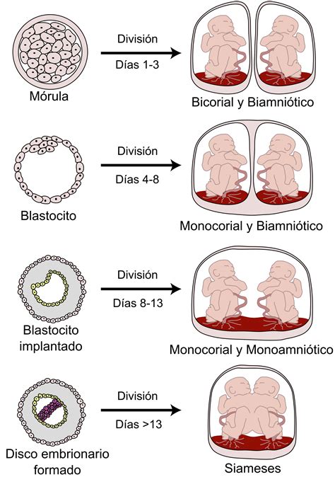 Diagrama que ilustra las diferentes configuraciones de placentas y sacos amnióticos en embarazos gemelares (bicorial-biamniótico, monocorial-biamniótico, monocorial-monoamniótico).
