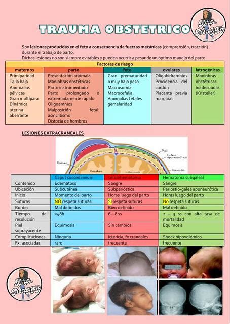 Ilustración de un bebé con posible trauma obstétrico en el área del hombro y cuello
