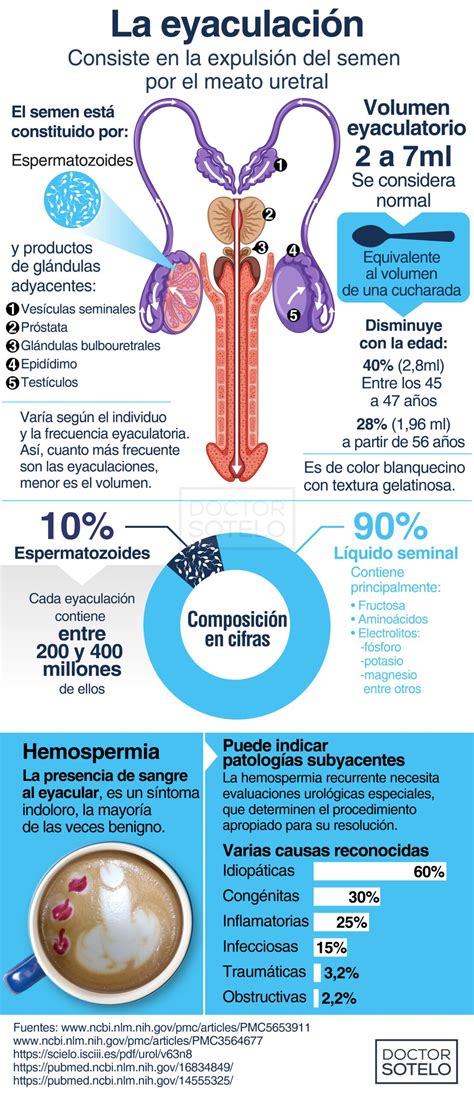Esquema anatómico comparativo entre una eyaculación normal y una eyaculación retrógrada hacia la vejiga