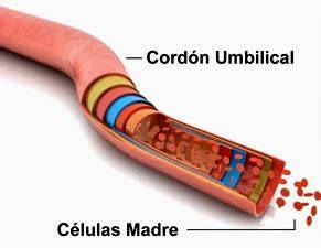 Infografía comparativa de células madre de médula ósea y cordón umbilical