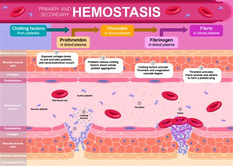Esquema de las fases de la hemostasia primaria y secundaria, mostrando la interacción de plaquetas y factores de coagulación.