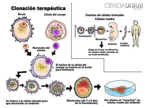 Diagrama que ilustra el proceso de clonación terapéutica, desde la transferencia nuclear hasta el cultivo de células madre.