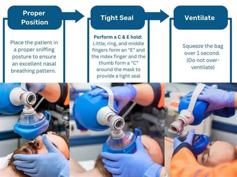 Fotografía o esquema de la técnica de ventilación con bolsa-válvula-mascarilla a dos manos (agarre CE)