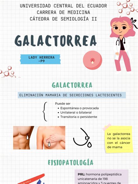 Esquema de las causas y síntomas de la galactorrea