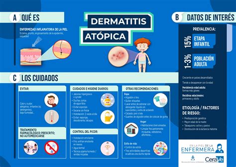 Infografía sobre la dermatitis atópica en niños y su tratamiento