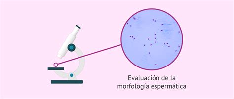 Infografía sobre la movilidad y morfología espermática ideal para la inseminación artificial