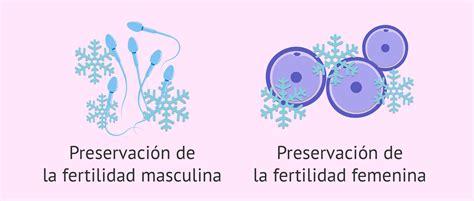 Esquema sobre la preservación de la fertilidad y la fecundación in vitro