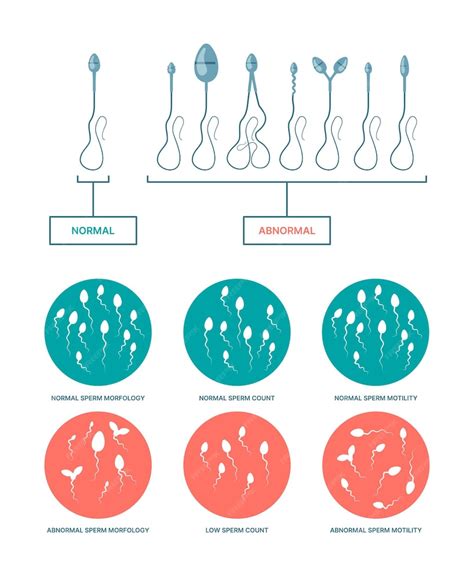 Infografía comparando espermatozoides sanos y dañados por el tabaco