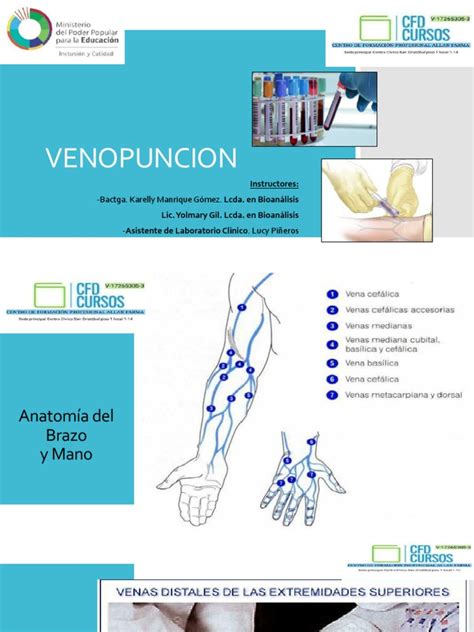 Ilustración detallada de una venopunción para extracción de sangre