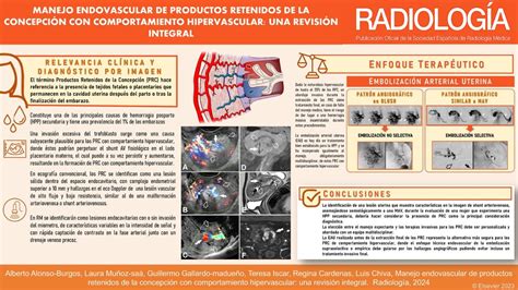 Infografía sobre la retención de productos de la concepción (RPOC), causas y síntomas.