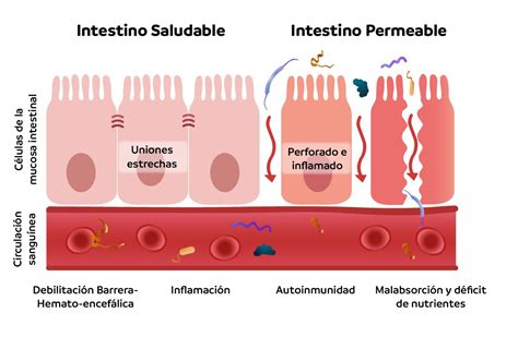 Infografía comparando la permeabilidad intestinal normal con la aumentada y mostrando cómo el calostro ayuda a restaurarla.