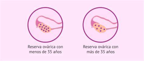 Gráfico de la reserva ovárica y la edad de la mujer