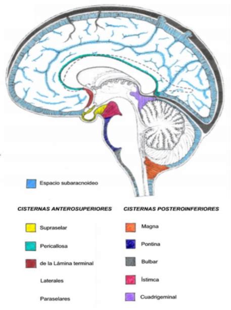 Esquema anatómico comparativo que muestra el aumento del espacio subaracnoideo frontal y el tamaño ventricular normal en contraste con un cráneo sano.