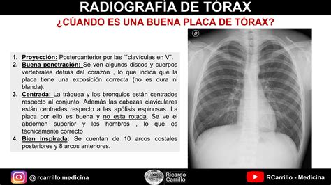 Ejemplo comparativo de radiografía periapical normal frente a una patología común en dentición temporal.