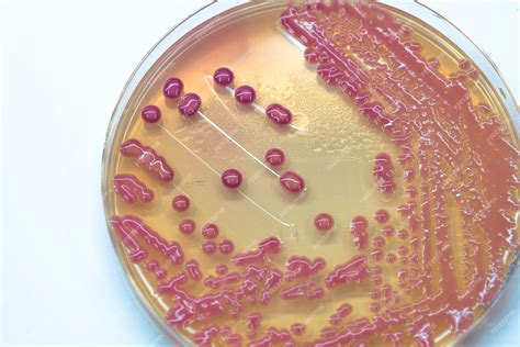 Placa de cultivo con colonias puntiformes de Eikenella corrodens en agar chocolate