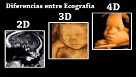 Infografía comparativa: diferencias entre ecografía convencional 2D y la tecnología 3D/4D para reconocimiento fetal.
