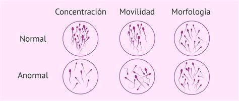 Infografía sobre los parámetros del espermiograma: cómo afectan la edad y el estilo de vida a la movilidad y morfología.