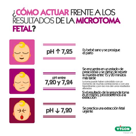 Esquema explicativo del procedimiento de microtoma de sangre fetal en la calota durante el parto.
