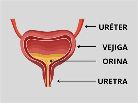 Esquema anatómico mostrando la diferencia entre la vejiga y la vagina para identificar el origen de la infección.