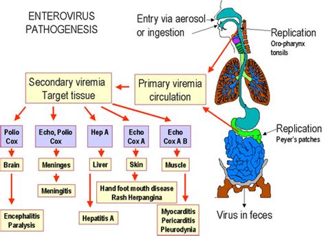 Esquema de la patogenia de los enterovirus: transmisión fecal-oral, replicación intestinal y viremia secundaria hacia el sistema nervioso central.