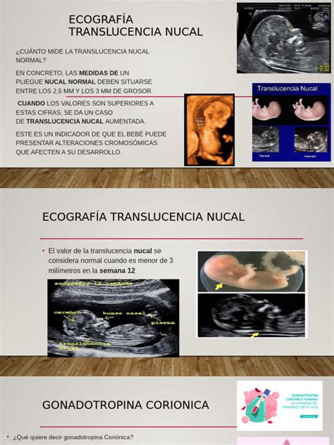 Esquema de la medición de la translucencia nucal y otros marcadores precoces de cromosomopatías.