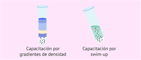 Esquema comparativo de las técnicas de capacitación espermática: Swim-up vs Gradientes de densidad.
