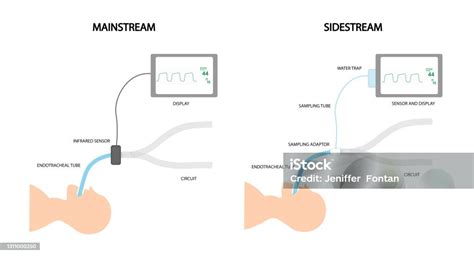 Diagrama comparativo de los sistemas de capnografía mainstream y sidestream, resaltando la adaptación para neonatos en este último.
