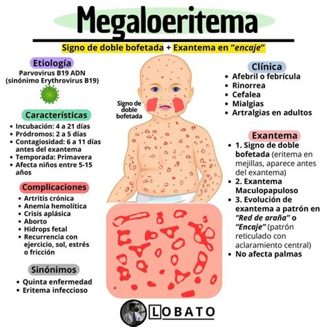 Esquema de las fases de la erupción del megaloeritema