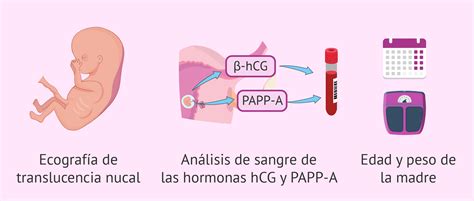Infografía del flujo de trabajo desde el cribado prenatal hasta el diagnóstico y seguimiento