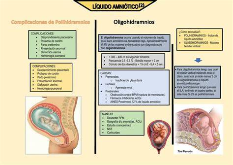 Diagrama comparativo de útero con oligohidramnios y polihidramnios
