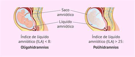 Muestras de líquido amniótico de diferentes colores (transparente, rosado, verde/marrón)