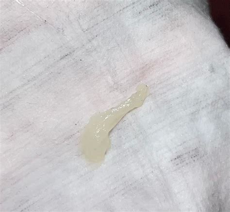 Tabla de colores del tapón mucoso: transparente, blanco, amarillo, rosado, rojo, marrón