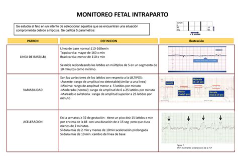 Representación esquemática de la monitorización fetal