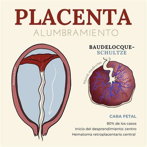 Ilustración del alumbramiento de la placenta