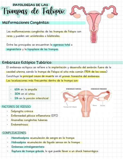 Infografía detallando la anatomía de la trompa de Falopio y la ubicación de un embarazo ectópico.