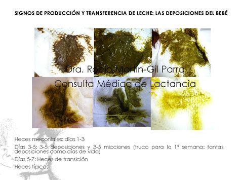 Infografía: Tipos de deposiciones del recién nacido (meconio, transición, leche materna, fórmula)