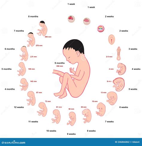 Ilustración comparativa del tamaño de un feto macrosómico y un feto de peso normal.