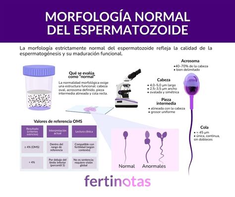 Infografía sobre la morfología de los espermatozoides y las causas de la teratozoospermia