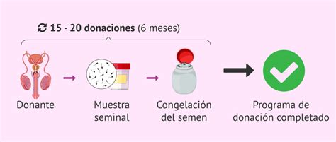 Esquema que ilustra el proceso de donación de semen, desde la selección del donante hasta la aplicación en técnicas de reproducción asistida.