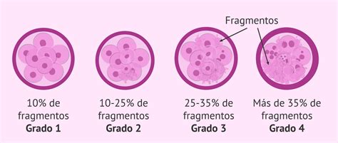 Esquema visual que muestra la progresión de la fragmentación embrionaria desde el grado 1 al 4, ilustrando la distribución de restos celulares respecto a los blastómeros.