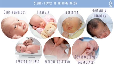 ilustración de los signos de deshidratación en un bebé